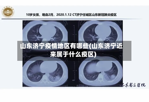 山东济宁疫情地区有哪些(山东济宁近来属于什么疫区)-第3张图片